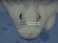 Toxic anterior segment syndrome associated with indocyanine green dye in experimental rabbit model